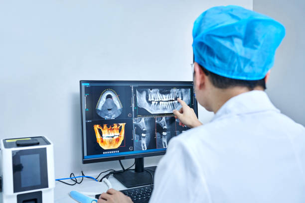 Best Emergency Root Canal Treatment in South El Monte, CA